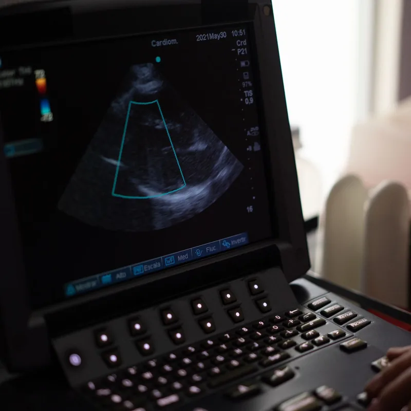 Ultrasound machine in a diagnostic imaging clinic