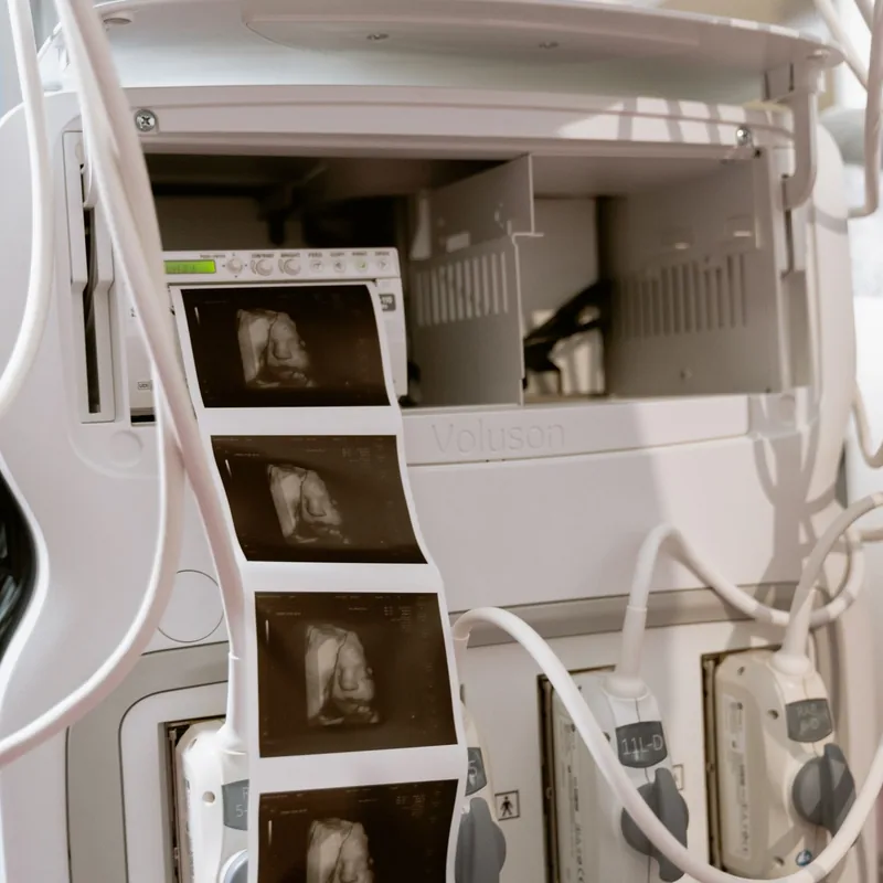 imaging-035 Ultrasound machine in a diagnostic imaging clinic