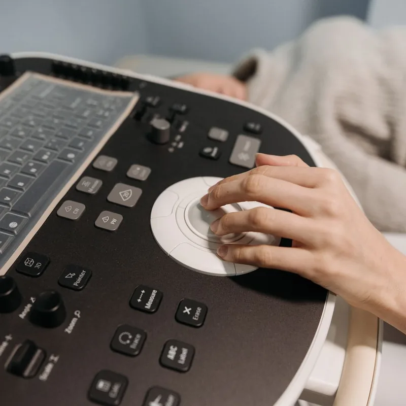 Ultrasound machine in a diagnostic imaging clinic