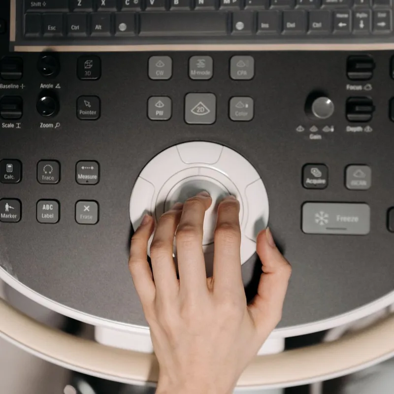 Ultrasound machine in a diagnostic imaging clinic
