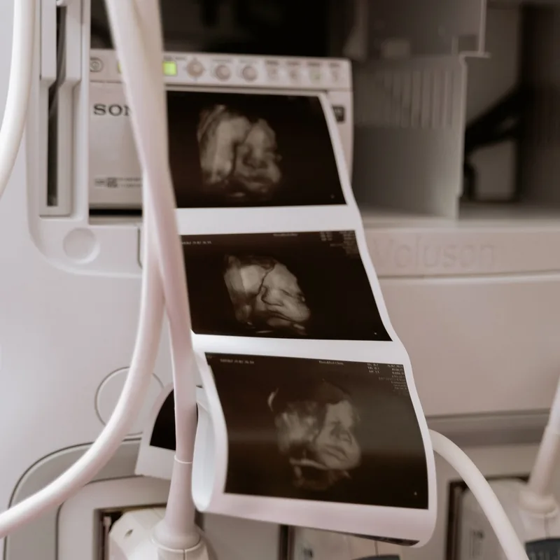 Ultrasound machine in a diagnostic imaging clinic