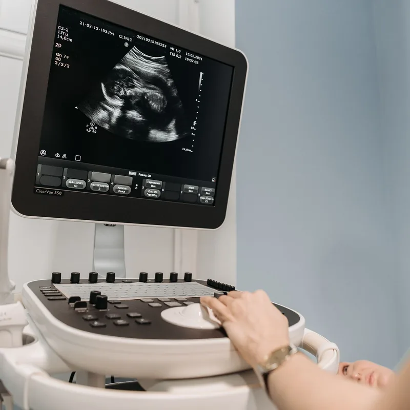 Ultrasound machine in a diagnostic imaging clinic