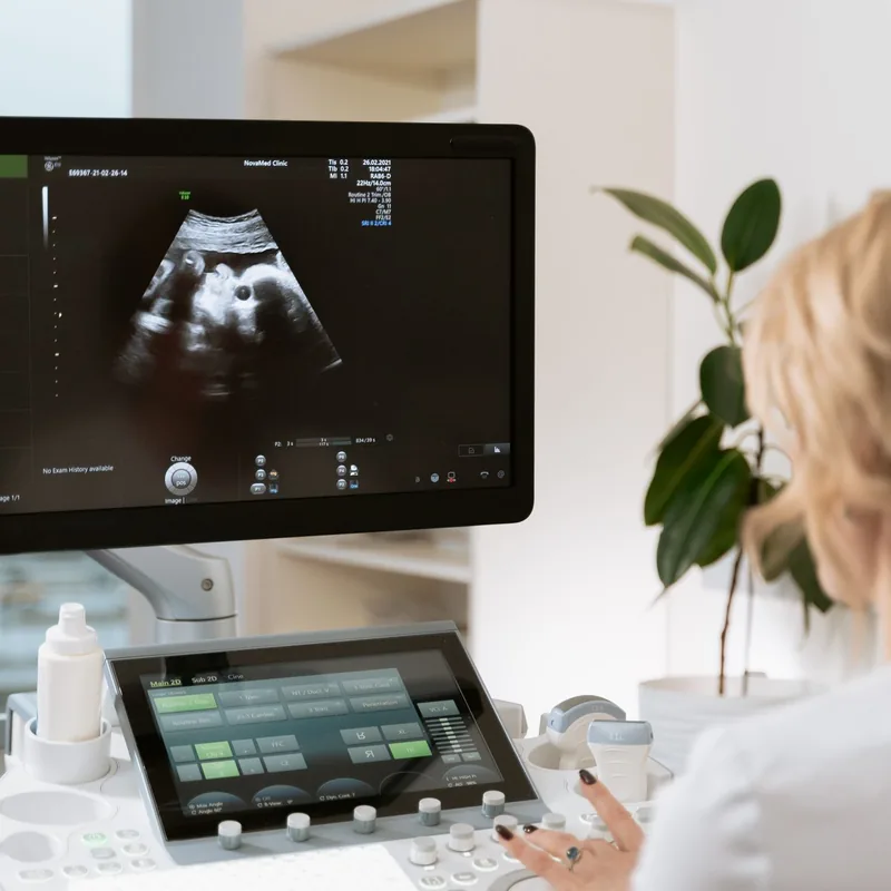 Ultrasound machine in a diagnostic imaging clinic