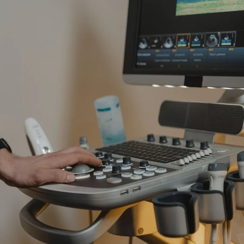 Ultrasound machine in a diagnostic imaging clinic
