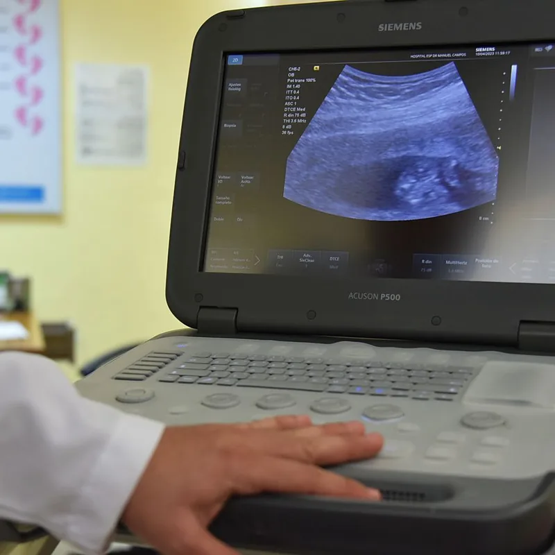 Ultrasound machine in a diagnostic imaging clinic