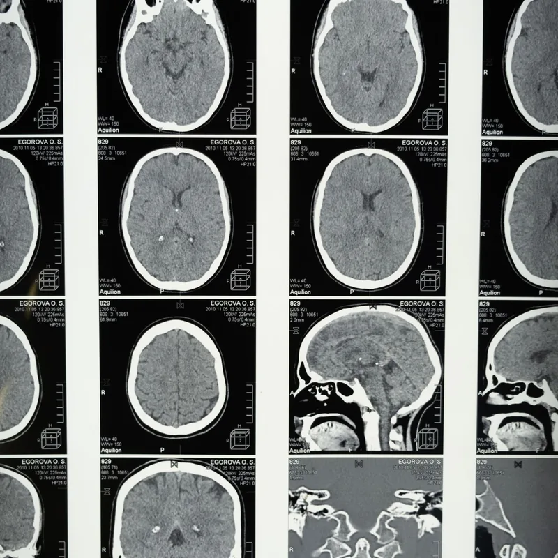imaging-071 Diagnostic imaging scans reviewed in a clinic